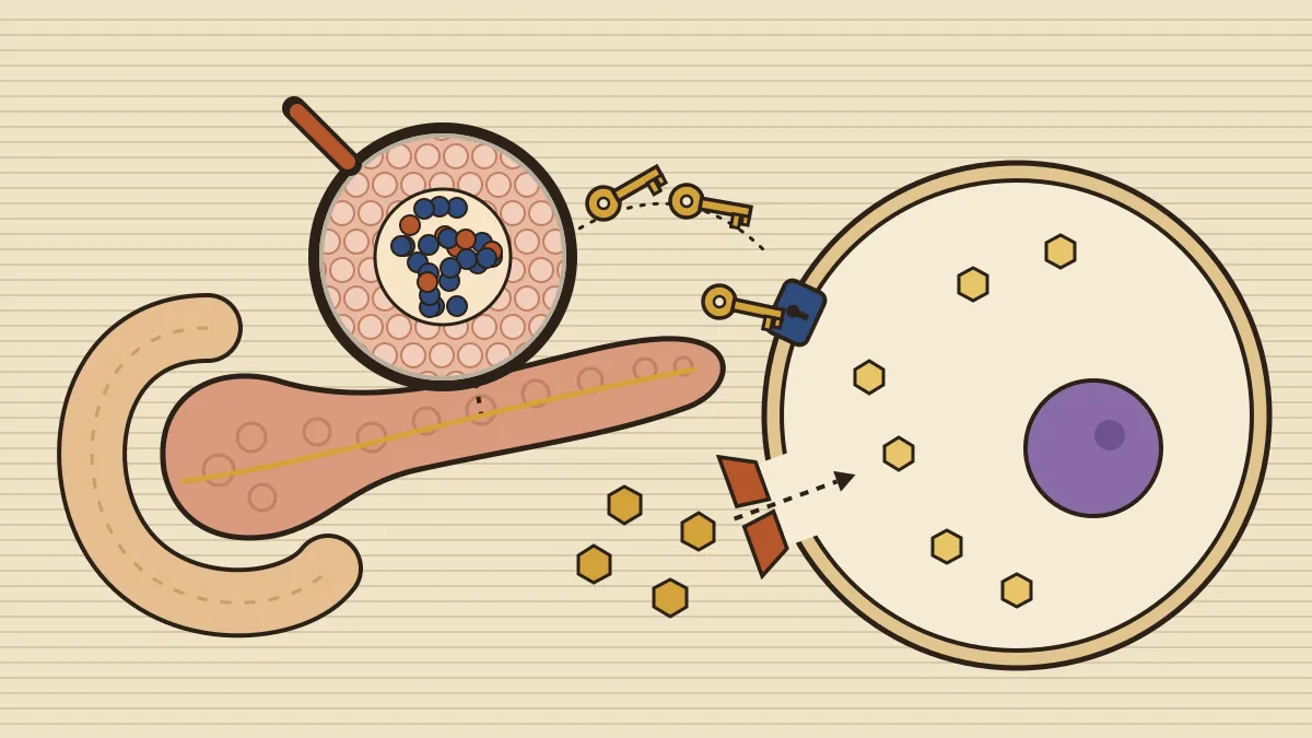 Illustration of the pancreas with a magnifying lens on an islet, insulin shown as keys that unlock a body cell so glucose can enter